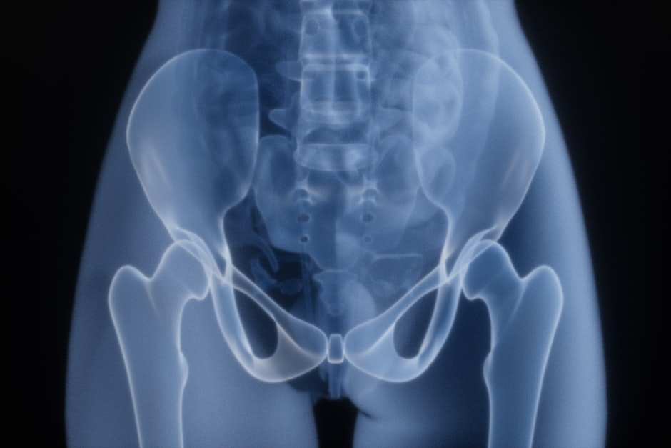 An X-ray of the pelvis and hip joints