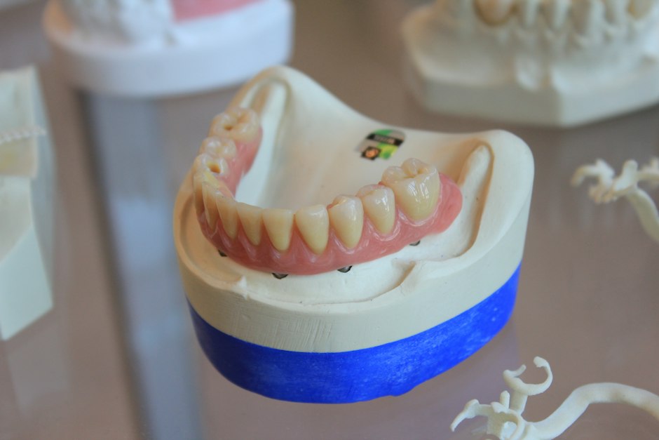 All-on-4 dental implants abroad cost comparison Turkey Mexico Hungary
