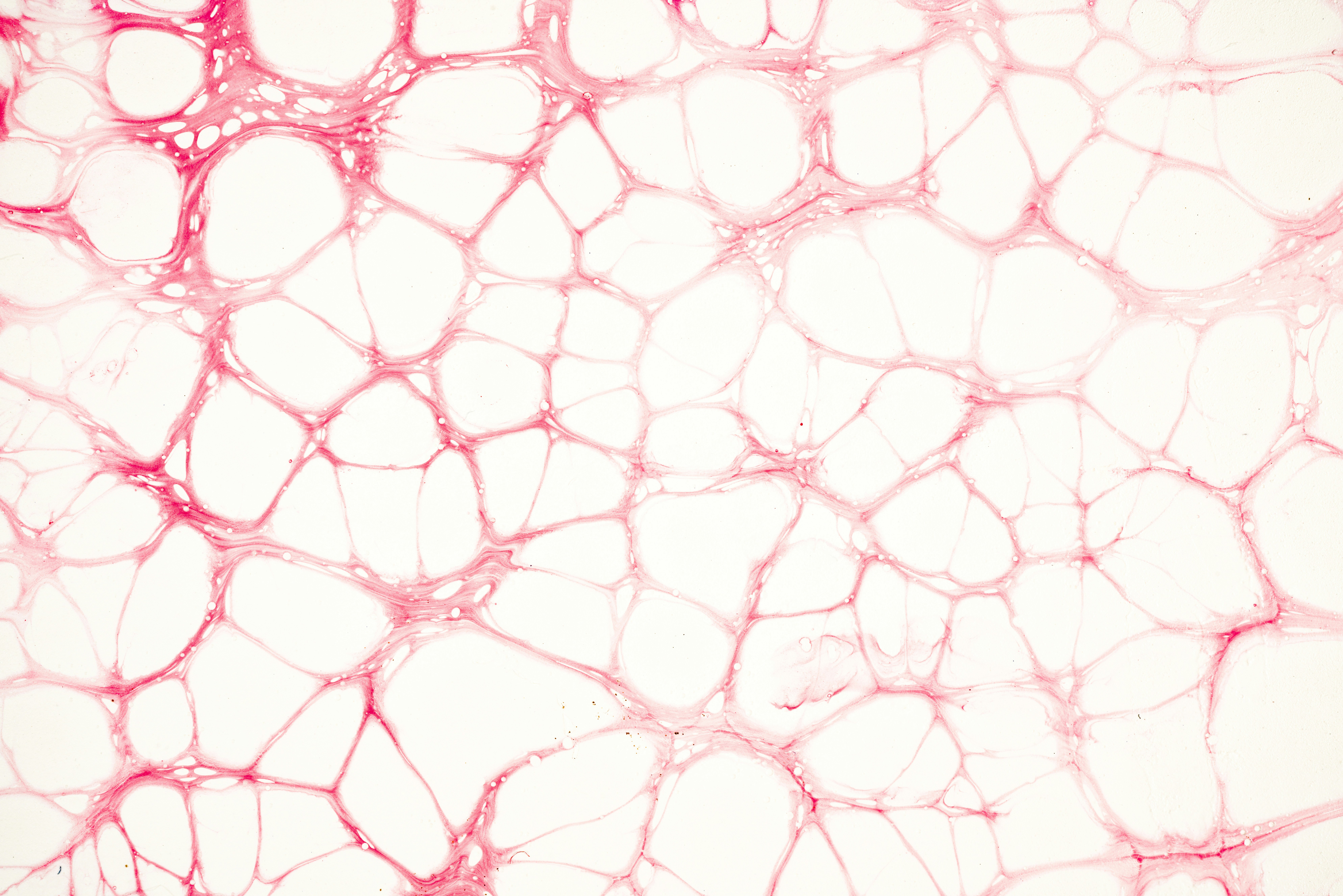 Stem cell therapy abroad Panama Mexico regenerative medicine insurance